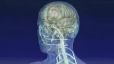 Vaccine for Multiple Sclerosis
