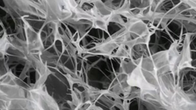 Bone Regeneration